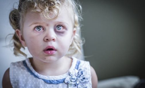“Hulp aan mishandelde kinderen ondergeschikt aan regelzucht”